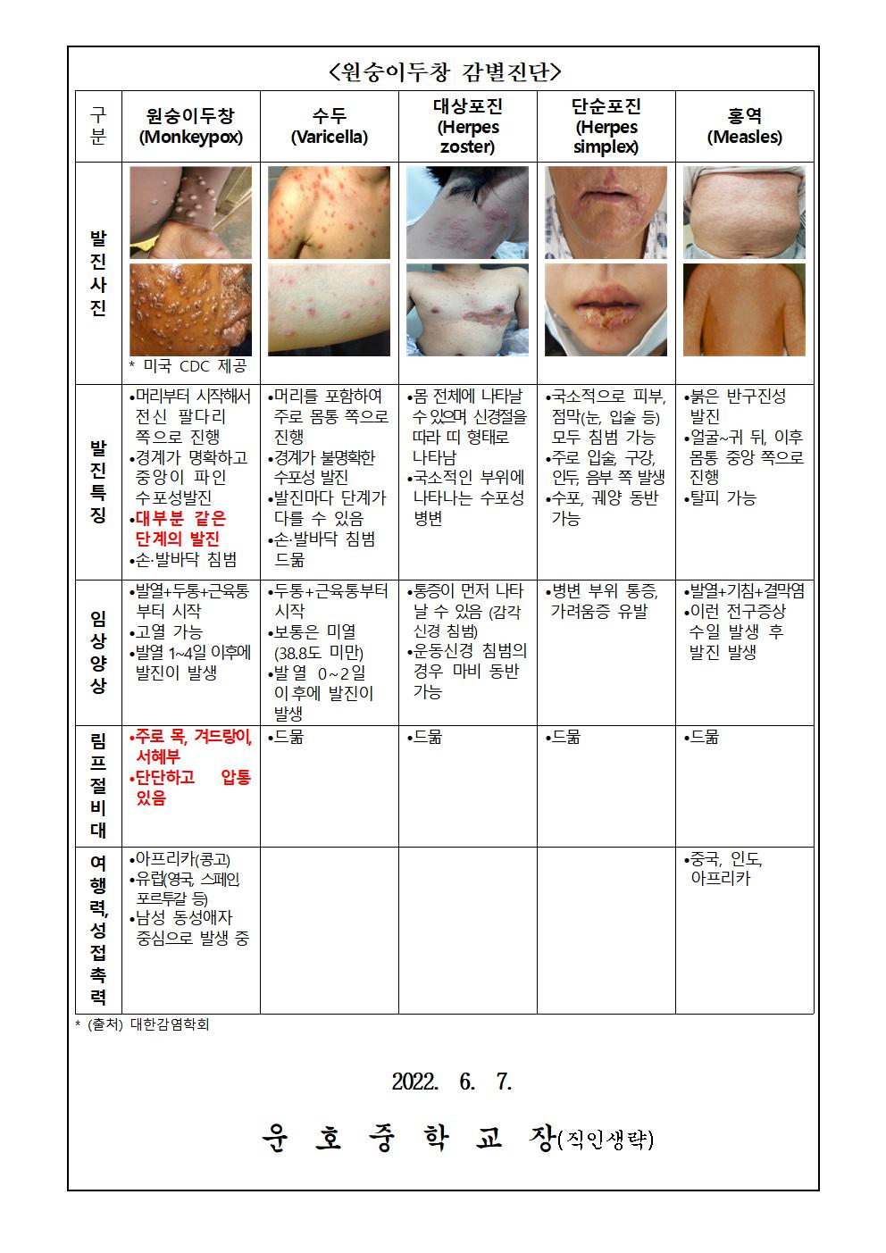 국외 원숭이 두창 대비, 위기경보 관심단계 발령002