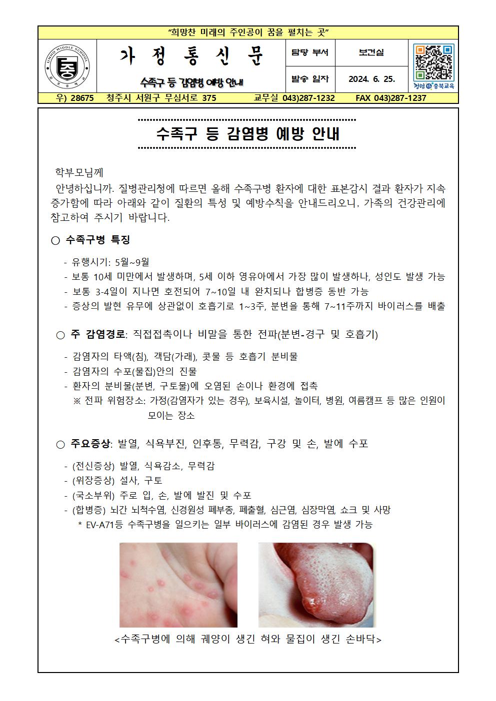 수족구 등 감염병 예방 안내001